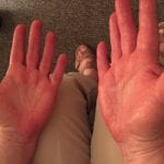 painful hands Reflexology Healing Medfield MA