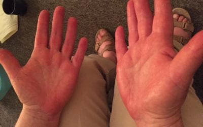 Reflexology Can Help to Break Arthritic Pain