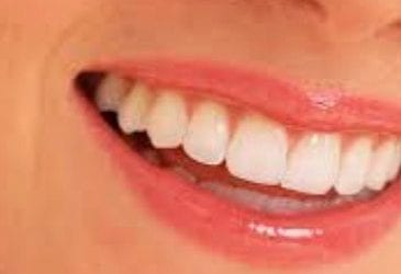 A client came in with aching teeth due to dental post implants. I thought it would be a good idea to…