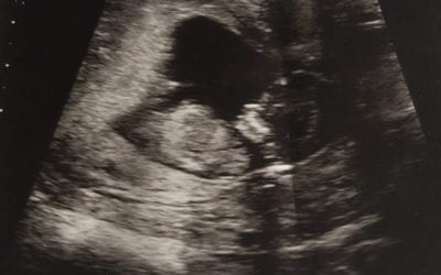 Fertility Support with Reflexology