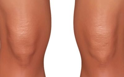 Got #kneepain pain? Try this #reflexology tip http://www.modernreflexology.com/reflexology-treatment-for-knee-pain/