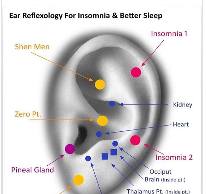 I finally broke the #insomnia cycle. Two weeks of no sleep. I used this #earreflexology map focusing on the red, yellow and purple points. #ear #reflexology