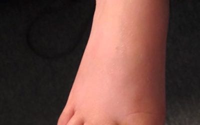 My favorite 6 year old feet came for a maintenance #reflexology today keep him #healthy through the winter months. He has been coming since he was 3 years old. He rarely catches #colds. What do you do to keep healthy?