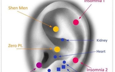 I finally broke the #insomnia cycle. Two weeks of no sleep. I used this #earreflexology map focusing on the red, yellow and purple points. #ear #reflexology