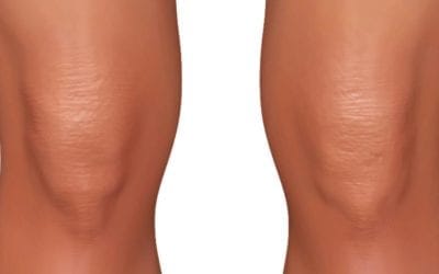 Got #kneepain pain? Try this #reflexology tip http://www.modernreflexology.com/reflexology-treatment-for-knee-pain/