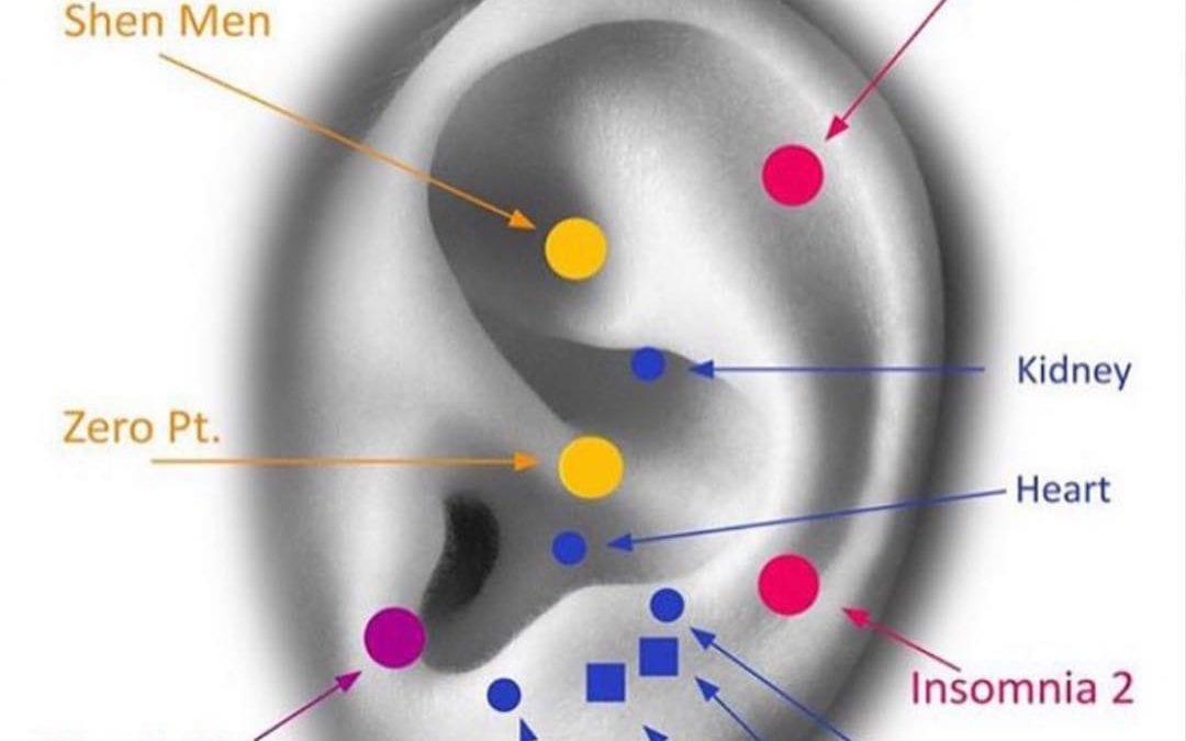 I finally broke the #insomnia cycle. Two weeks of no sleep. I used this #earreflexology map focusing on the red, yellow and purple points. #ear #reflexology #healingplacemedfield