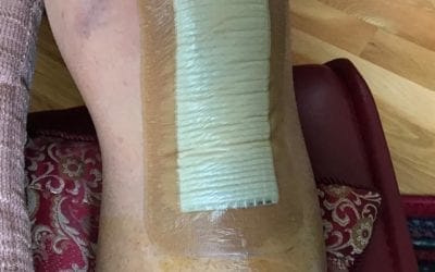 To help my husband to relieve the pain from knee replacement, here are 4 foot reflexology tips to: Relieve pain Drain buildup fluid in the leg Relieve constipation to medication Support the knee https://youtu.be/FnQjPoEmIGI If you would like to make an appointment to support your health with reflexology call the Healing Place 508-359-6463. #energyhealing #bewell #chakras #positivity #ENERGY #mindbodyspirit #selfhealing #holistic #reiki #health #belight #energyhealers #energymedicine #reflexology #footreflexology #mindfulness #healing #howto