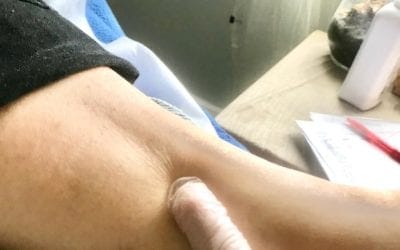 Reflexology Spleen 6 Point