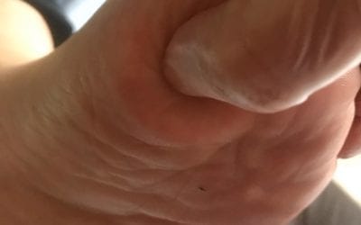 Video: Numbness and Neuropathy Relief – Hand Reflexology Tip