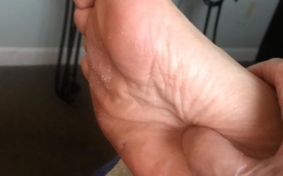 Video: Kidney Stone Pain Relief – Hand Reflexology Tip