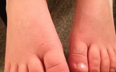 I love doing reflexology on children. Some of the children have been coming for reflexology services for more than a decade. Watching them grow have been amazing while keeping them healthy. Healingplace in medfield, Ma 508.359.6463 #reflexology #wellness #childrenhealth #holistichealth #healthychildren #digestivehealth