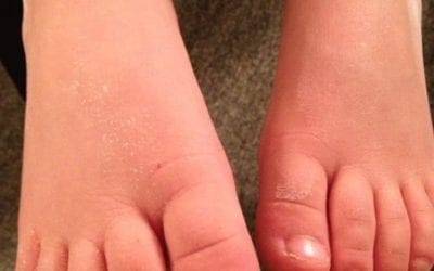 I love doing reflexology on children. Some of the children have been coming for reflexology services for more than a decade. Watching them grow have been amazing while keeping them healthy. Healingplace in medfield, Ma 508.359.6463 #reflexology #wellness #childrenhealth #holistichealth #healthychildren #digestivehealth