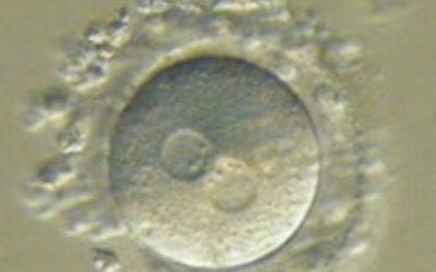 Client with #PCOS was able to conceived with the help of #reflexology but unfortunately she miscarriaged. So sad. The good news is that she was able to conceived where she thought it wasn’t possible before reflexology. We are praying that next month will be the month. Exploring how reflexology can support your health? Healing place (508) 359-6463 #wellness #healing #energyhealing #healingplacemedfield #healingplaceenergyschool