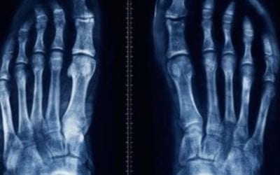 Healthy shoes for life. You can avoid foot deformities and pain by wearing the right shoes. Once your feet are damaged it can become a life time of pain. With every reflexology session i include sore foot muscles therapy. HealingPlace 508.359.6463. #footwear #painrelief #takecare #reflexology #healingplacemedfield #healingplaceenergyschool