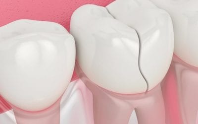 This client went up the dentist recently. The dentist told her she is #Clenching her teeth too much. Dentist found two cracked teeth. Patient’s response was “my reflexologist has been telling me I’ve been clenching for months!” This is how sensitive #Reflexology is. Reflexology can detect the slightest #energy imbalance. Learn how reflexology can help you to #heal or keep you #healthy. #healingplacemedfield or call (508)359-6463.