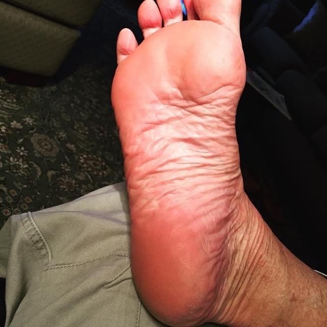 This client is excited about his #reflexology session that he sent me a picture of his foot. He had been coming for #healing sessions since 2005. He suffers from #arthritis in his #joints and #hips. Find how to break the pain in 4 reflexology sessions. #healingplacemedfield (508) 359-6463 #wellness #selfcare