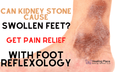 Can #KidneyStone Cause Swollen Feet? Pain Relief and Support With #FootReflexology #edema