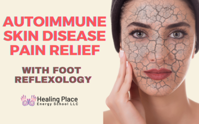 Autoimmune Skin Disease Pain Relief with #FootReflexology #AutoimmuneSkinDiease #SkinPainRelief #ReflexologyNearMe #HealingPlaceEnergySchool