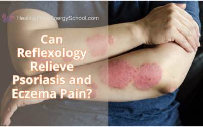 Can Reflexology Relieve Psoriasis and Eczema Pain? #HealingPlaceEnergySchool #EczemaandPsoriasisPainRelief